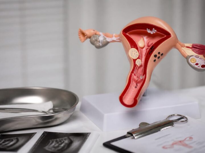 75% dintre femei au cel puțin o infecție vaginală cu ciuperci și mâncărimea poate avea mai multe cauze