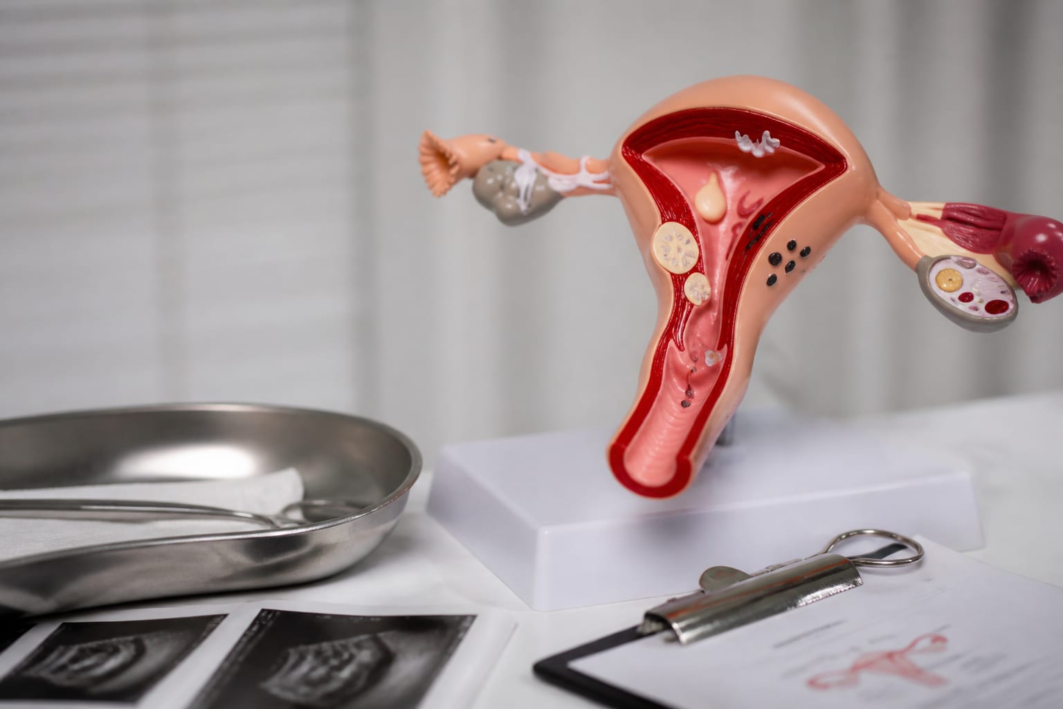 75% dintre femei au cel puțin o infecție vaginală cu ciuperci și mâncărimea poate avea mai multe cauze