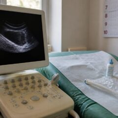 Diagnosticul de endometrioză durează până la 10 ani. De ce durerile menstruale severe nu trebuie ignorate