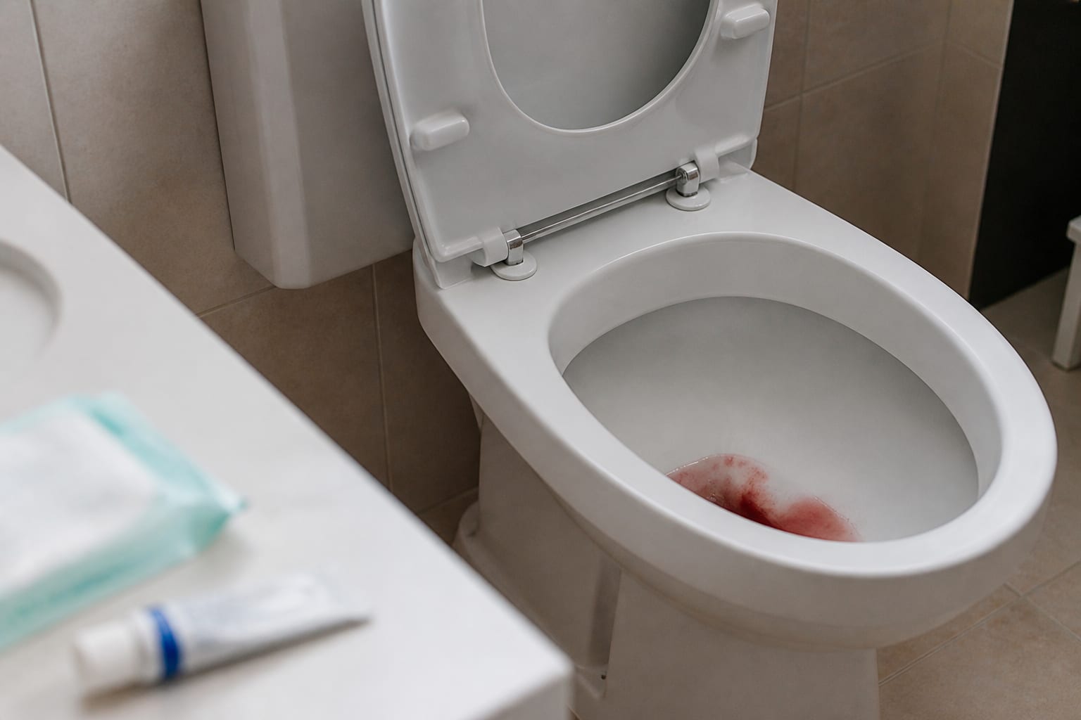 Sângerările anormale înainte de 40 de ani. Un medic explică semnalele ce nu trebuie ignorate