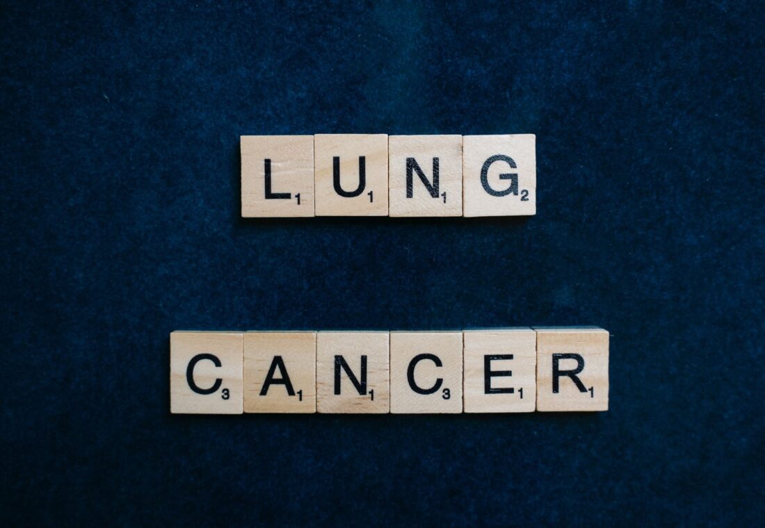 Doar unul din cinci pacienți ajunși târziu cu cancer pulmonar mai poate beneficia de operație curativă